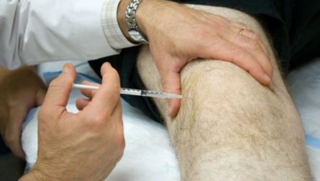 El plasma rico en plaquetas mejora la artrosis de rodilla