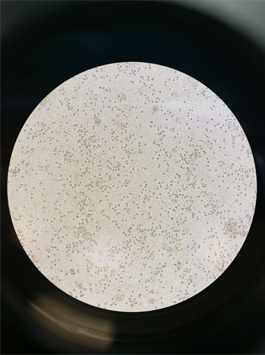 MR tratmiento regenerativo celulas laboratorio Tratamiento regenerativo