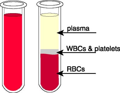 MR2 medicina regenerativa sangre plasma rico en plaquetas Tratamiento regenerativo